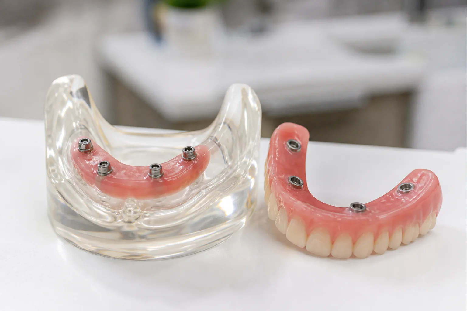 Implant-Supported Dentures for Valencia patients